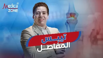 علاج تيبس المفاصل الكتفية