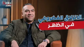 أسباب الانزلاق الغضروفي في الظهر وطرق التعامل معه