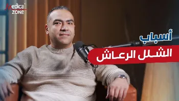 أسباب الشلل الرعاش وأعراضه 