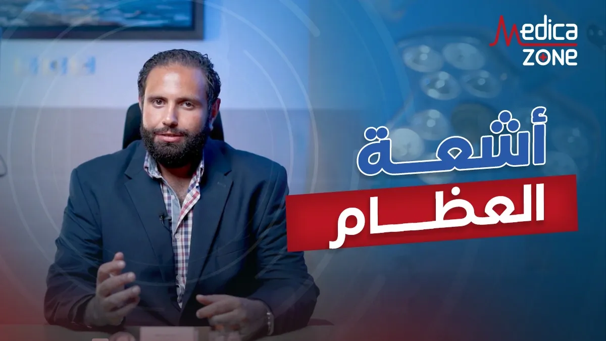 خلفية ميديكازون