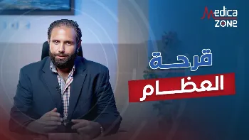 قرحة العظام وكيفية التعامل معها