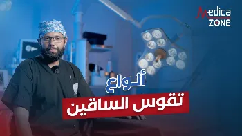 طرق علاج انواع تقوس الساقين