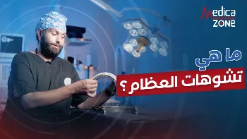 أنواع الأجهزة المُستخدمة في جراحات إصلاح تشوه العظام 