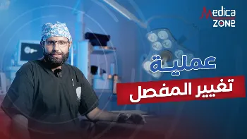 ما تكلفة عملية تغيير المفصل؟