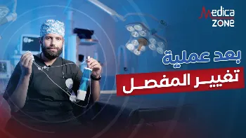 هل يشعر المريض بألم ما بعد عملية تغيير مفصل الركبة؟