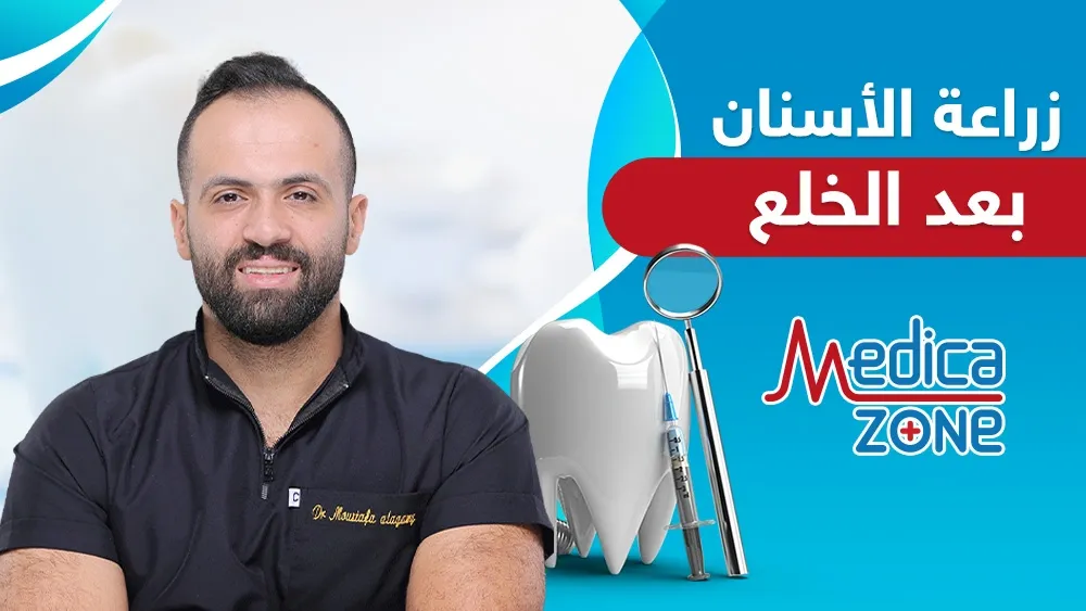 خلفية ميديكازون