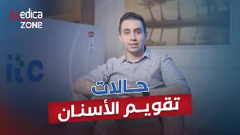 تعرف إلى حالات تقويم الاسنان والسن المناسب لتركيبه