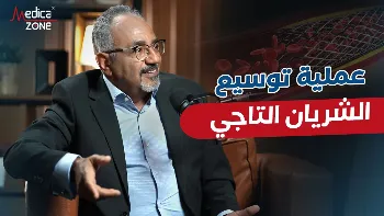 عملية توسيع الشريان التاجي