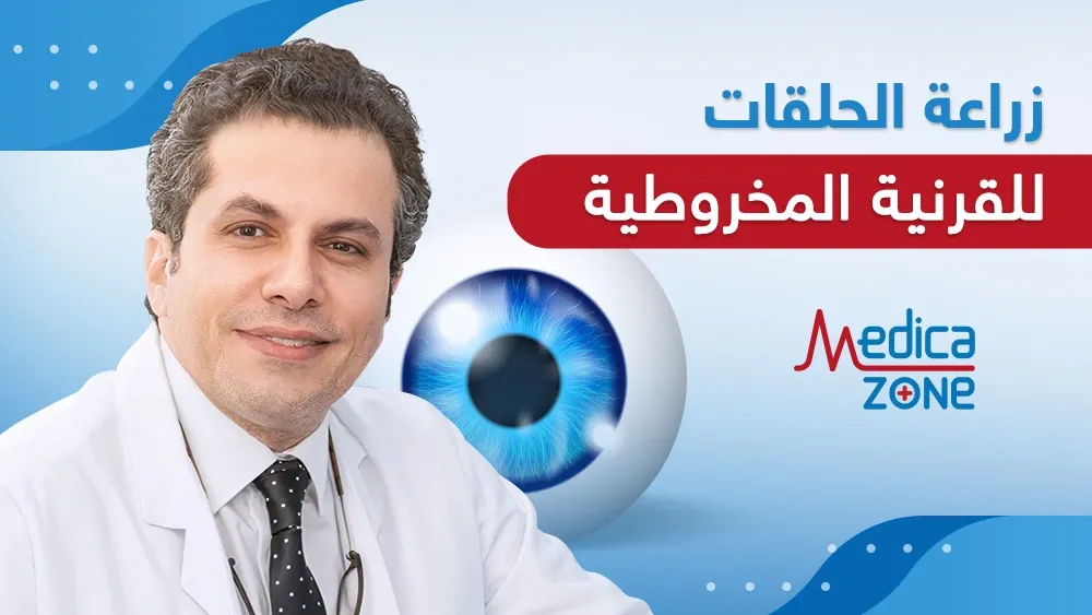 خلفية ميديكازون