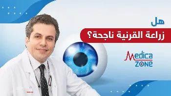 هل زراعة القرنية ناجحة؟
