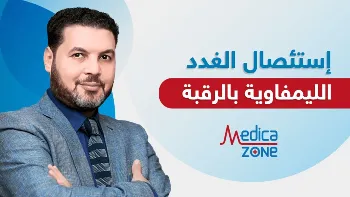 متى يجب استئصال الغدد الليمفاوية بالرقبة؟