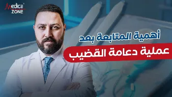 أهمية المتابعة بعد عملية دعامة القضيب