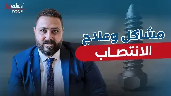 ما أسباب مشاكل الانتصاب؟ وكيف تؤثر على القدرة الجنسية؟