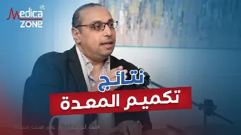 هل تعتمد نتائج تكميم المعده على خطوات الجراحة فقط؟