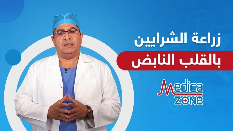 خلفية ميديكازون