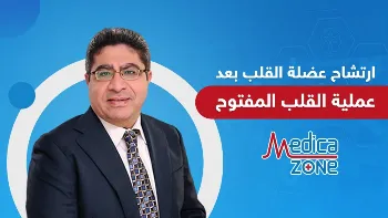 اعراض الارتشاح بعد عملية القلب المفتوح