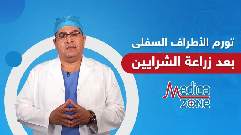 خلفية ميديكازون