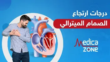 ما هي درجات ارتجاع الصمام الميترالي؟ وأيهم أخطر؟