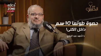حصوات الكلى والحالب... أسبابها وطرق اكتشافها وعلاجها