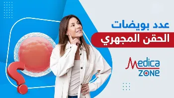 كم عدد البويضات المناسب للحقن المجهري؟