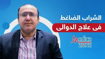 الشراب الضاغط لمرضى الدوالي: هل يعد بديلًا للجراحة؟