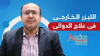  ازالة الدوالي بالليزر الخارجي وقسطرة الليزر