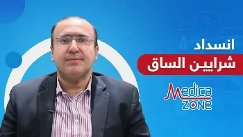انسداد شرايين الساق
