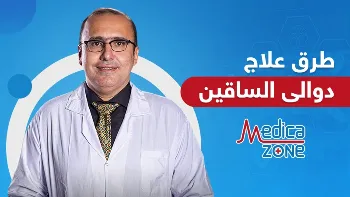 وسائل علاج دوالي الساقين