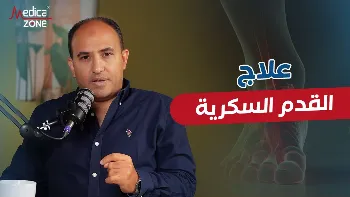 تعرف إلى أسباب القدم السكرية وعلاجها