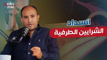انسداد الشرايين في الرجل| أسبابها والتخصص الطبي المعني بعلاجها