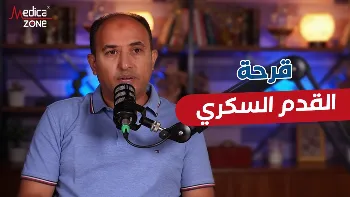 قرحة القدم السكري