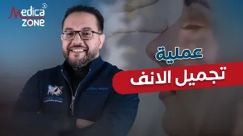 كل ما تريد معرفته عن عملية تجميل الأنف