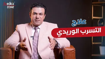 ما هو علاج التسرب الوريدي 2026؟