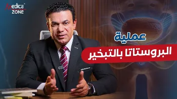 عملية البروستاتا بالتبخير| الخطوات والنتائج
