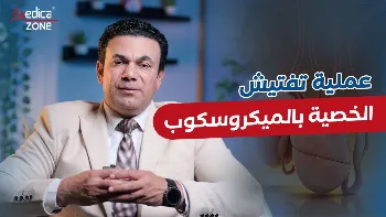 عملية تفتيش الخصية بالميكروسكوب لعلاج انعدام الحيوانات المنوية
