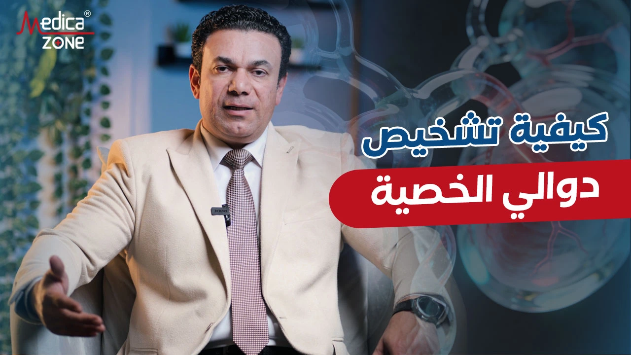 إليك كيفية تشخيص دوالي الخصية مع د/ صلاح زيدان