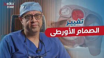 تقنية أوزاكي لتغيير الصمام الأورطي | جراحة قلب مبتكرة