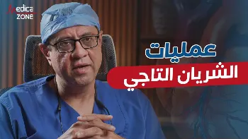 عمليات الشريان التاجي بالتقنيات الحديثة | رؤية دقيقة وأمان أعلى