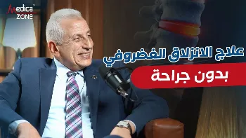 علاج الانزلاق الغضروفي بدون جراحة