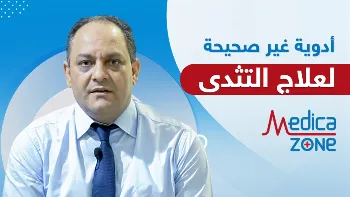 هل يوجد أدوية لعلاج التثدي عند الرجال؟