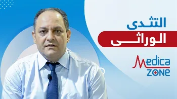 أسباب التثدي لدى الرجال: العامل الوراثي ليس الخطر الوحيد