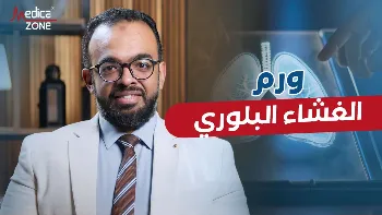 ما مضاعفات ورم الغشاء البلوري؟