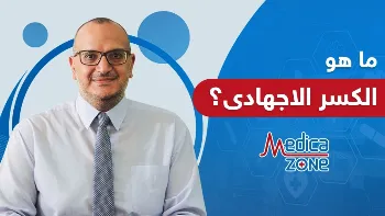 ما هو الكسر الإجهادي؟ احذر من رفع الأجسام الثقيلة
