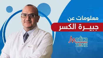 متى نحتاج إلى استخدام الجبيرة الصناعية لتثبيت كسور العظام؟