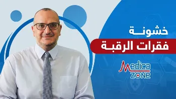 أعراض خشونة فقرات الرقبة وطرق علاجها