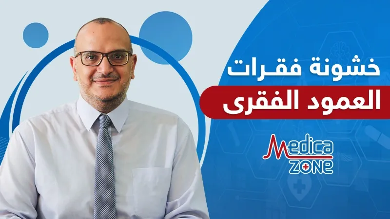 خلفية ميديكازون