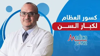هل كسور العظام عند كبار السن خطيرة؟ وكيف يمكن علاجها؟