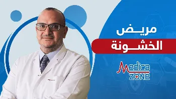 هل يفيد العلاج الطبيعي في علاج مرض الخشونة؟