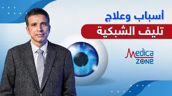 تعرف على أسباب تليف الشبكية