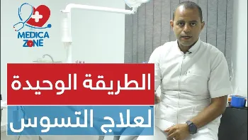 التسوس مرض لا يعالج